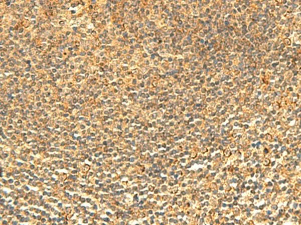 Immunohistochemistry of paraffin-embedded Human tonsil tissue using ABHD10 Polyclonal Antibody at dilution of 1:50(×200)