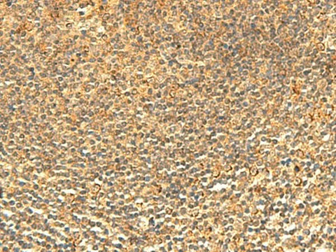 Immunohistochemistry of paraffin-embedded Human tonsil tissue using ABHD10 Polyclonal Antibody at dilution of 1:50(×200)