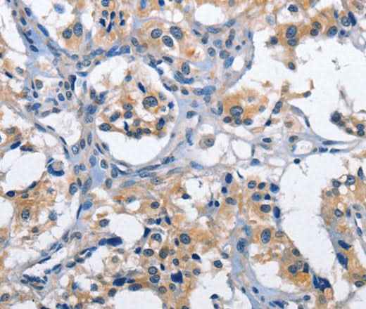 Anti-Human CLEC2D Antibody