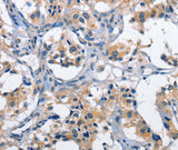 Anti-Human CLEC2D Antibody - ABMIUM