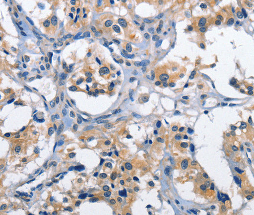 Anti-Human CLEC2D Antibody - ABMIUM