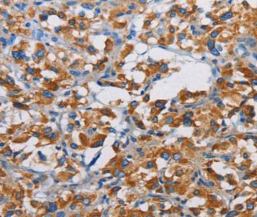 Anti-Human TSPEAR Antibody