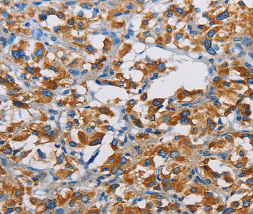 Anti-Human TSPEAR Antibody - ABMIUM