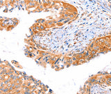 Anti-Human/Mouse/Rat AP1B1 Antibody - ABMIUM