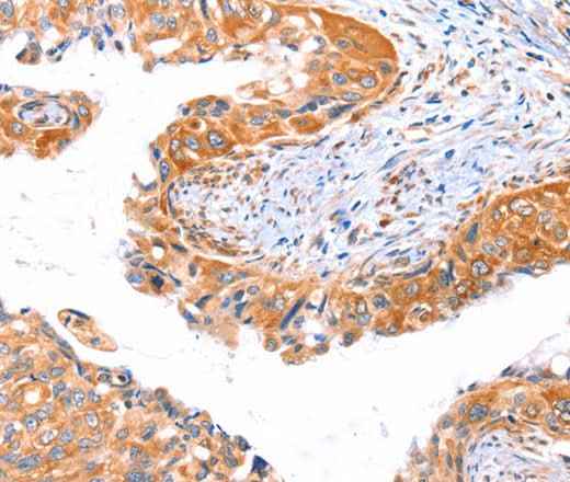 Anti-Human/Mouse/Rat AP1B1 Antibody