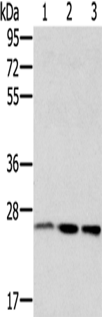 Anti-Human/Mouse/Rat RAB8A Antibody - ABMIUM