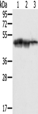 Anti-Human/Mouse SMARCB1 Antibody - ABMIUM