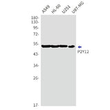 Western blot detection of P2Y12 in A549,HL-60,U251,U87-MG cell lysates using P2Y12 Rabbit mAb(1:1000 diluted).Predicted band size:40kDa.Observed band size:52kDa.