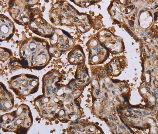 Anti-Human/Mouse/Rat KIF1C Antibody - ABMIUM