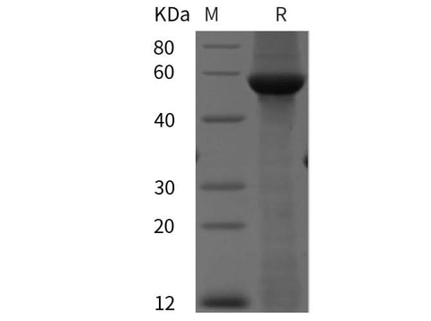 SDS-PAGE analysis of Human MMP1 proteins, 2 μg/lane of Recombinant Human MMP1 proteins was resolved with SDS-PAGE under reducing conditions, showing bands at 58 kDa.