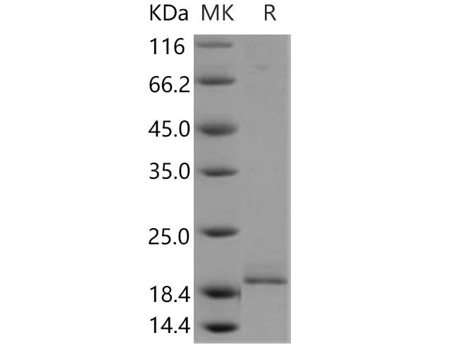 > 87 % as determined by reducing SDS-PAGE.