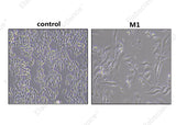 Morphological observations of RAW 264.7: untreated RAW 264.7 (left) cells show a round or oval morphology. RAW 264.7 Differentiated M1 macrophages (right) show irregular morphology and contain granular material in the cytoplasm.
