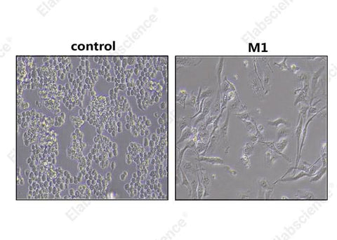 Morphological observations of RAW 264.7: untreated RAW 264.7 (left) cells show a round or oval morphology. RAW 264.7 Differentiated M1 macrophages (right) show irregular morphology and contain granular material in the cytoplasm.