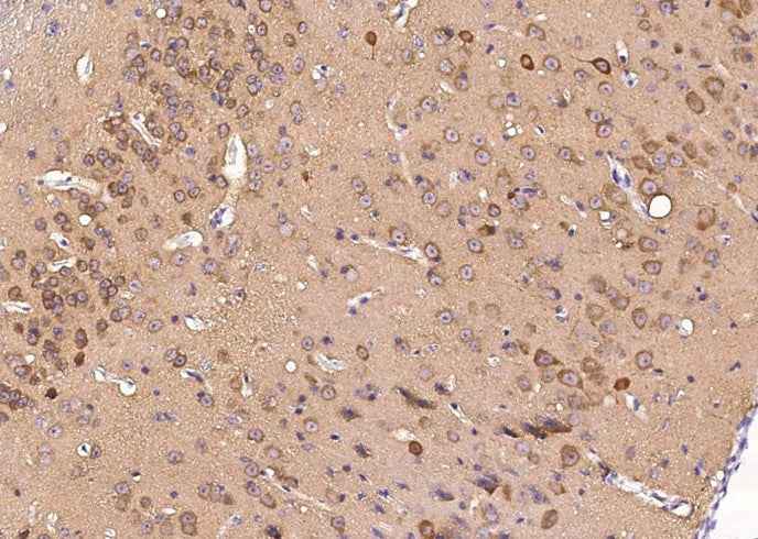 Anti-Mouse S100A5 Antibody [B447] - ABMIUM