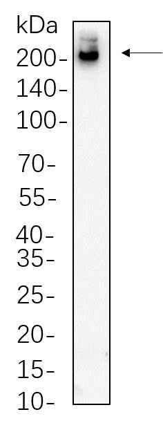 Anti-Human/Mouse/Rat Tuberin Antibody [B609] - ABMIUM