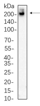 Anti-Human/Mouse/Rat Tuberin Antibody [B609]