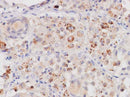 Anti-Human PDGF-AA Antibody - ABMIUM