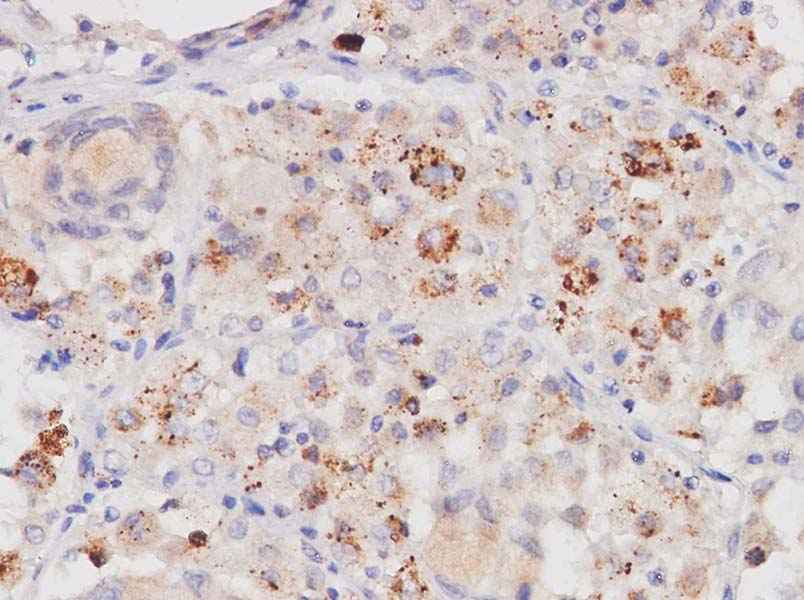 Anti-Human PDGF-AA Antibody - ABMIUM
