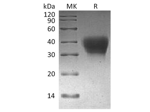 Recombinant Cynomolgus PD-1/CD279/PDCD1 Protein (His Tag) - ABMIUM