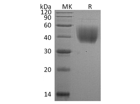 Recombinant Rat CD80/B7-1 Protein (His Tag) - ABMIUM