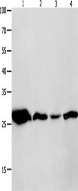 Anti-Human/Mouse/Rat YWHAQ Antibody - ABMIUM