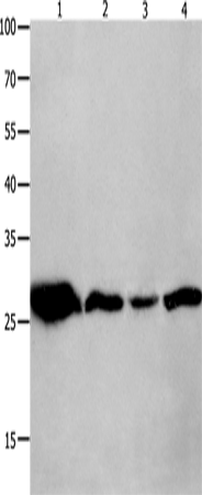 Anti-Human/Mouse/Rat YWHAQ Antibody - ABMIUM
