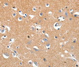 Anti-Human LRP3 Antibody - ABMIUM