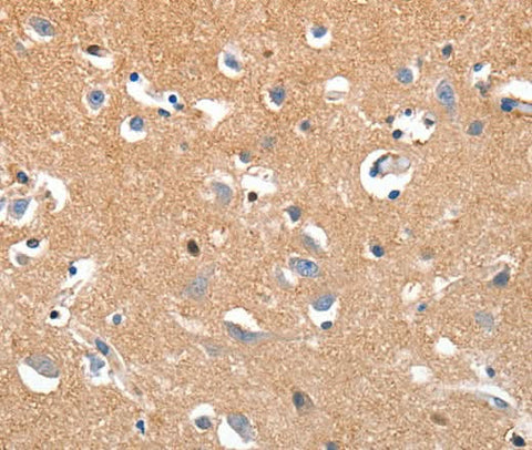 Anti-Human LRP3 Antibody - ABMIUM