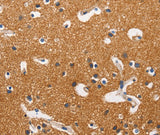 Anti-Human/Mouse/Rat HK2 Antibody - ABMIUM