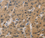 Anti-Human/Mouse/Rat DUSP26 Antibody - ABMIUM