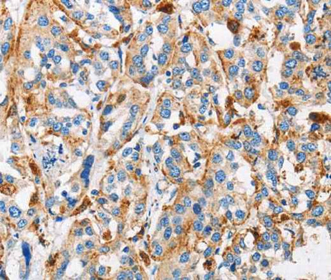 Anti-Human CTSL Antibody
