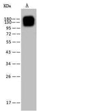 Anti-Human ANPEP Antibody [A1014] - ABMIUM