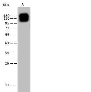 Anti-Human ANPEP Antibody [A1014] - ABMIUM
