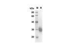 SDS-PAGE analysis of Human FCGR2A proteins, 2 μg/lane of Recombinant Human FCGR2A proteins was resolved with SDS-PAGE under reducing conditions, showing bands at 20.1 kDa.