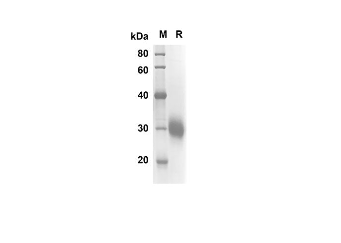 SDS-PAGE analysis of Human FCGR2A proteins, 2 μg/lane of Recombinant Human FCGR2A proteins was resolved with SDS-PAGE under reducing conditions, showing bands at 20.1 kDa.