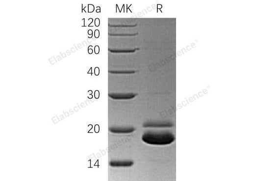 Recombinant Human TRAIL R2/TNFRSF10B Protein (His Tag) - ABMIUM