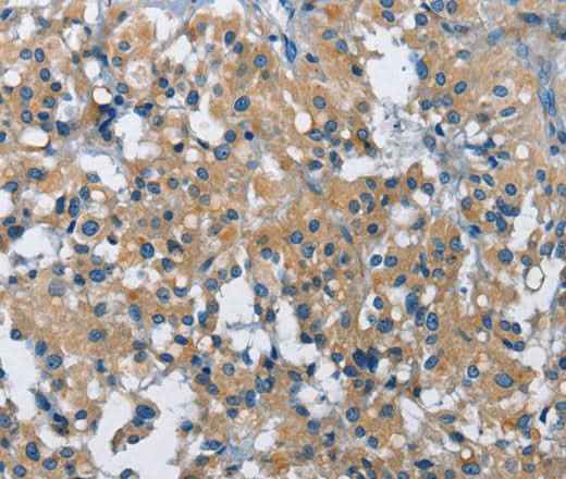 Anti-Human/Mouse BMPR1B Antibody
