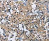 Anti-Human/Mouse BMPR1B Antibody - ABMIUM
