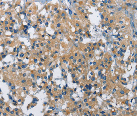 Anti-Human/Mouse BMPR1B Antibody - ABMIUM