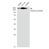Western blot detection of SMARCA2/BRM in A549,HL-60,U2OS cell lysates using SMARCA2/BRM Rabbit mAb(1:1000 diluted).Predicted band size:181kDa.Observed band size:190kDa.
