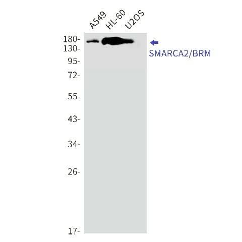 Western blot detection of SMARCA2/BRM in A549,HL-60,U2OS cell lysates using SMARCA2/BRM Rabbit mAb(1:1000 diluted).Predicted band size:181kDa.Observed band size:190kDa.