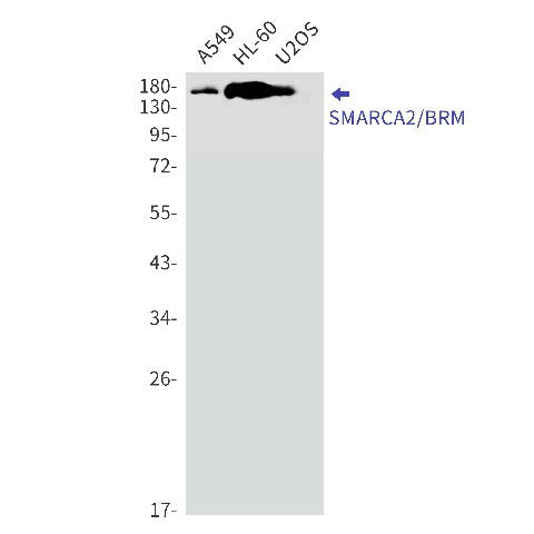 Western blot detection of SMARCA2/BRM in A549,HL-60,U2OS cell lysates using SMARCA2/BRM Rabbit mAb(1:1000 diluted).Predicted band size:181kDa.Observed band size:190kDa.