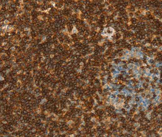 Anti-Human CD43 Antibody