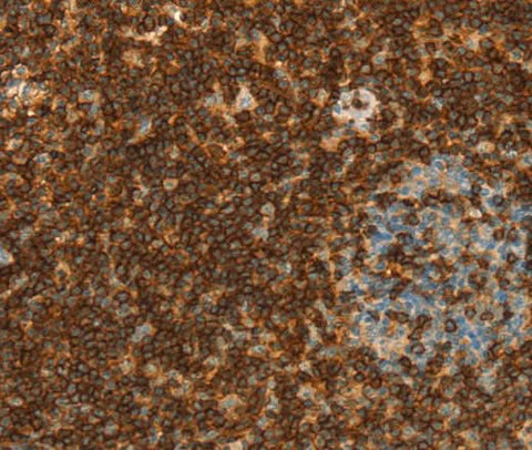 Anti-Human CD43 Antibody - ABMIUM