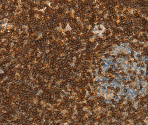 Anti-Human CD43 Antibody - ABMIUM