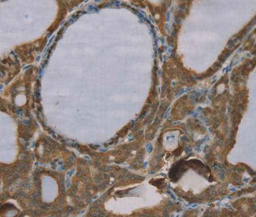 Anti-Human/Mouse/Rat S100A6 Antibody