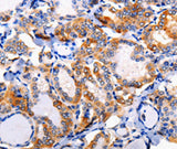 Anti-Human/Mouse/Rat AP1B1 Antibody - ABMIUM