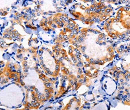 Anti-Human/Mouse/Rat AP1B1 Antibody