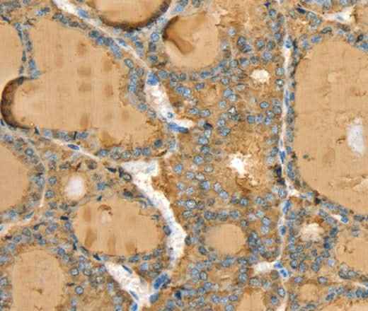 Anti-Human TG Antibody