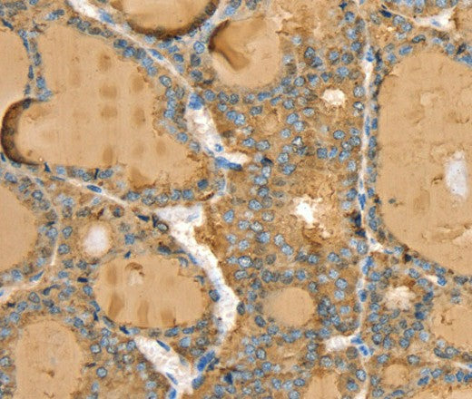 Anti-Human TG Antibody - ABMIUM